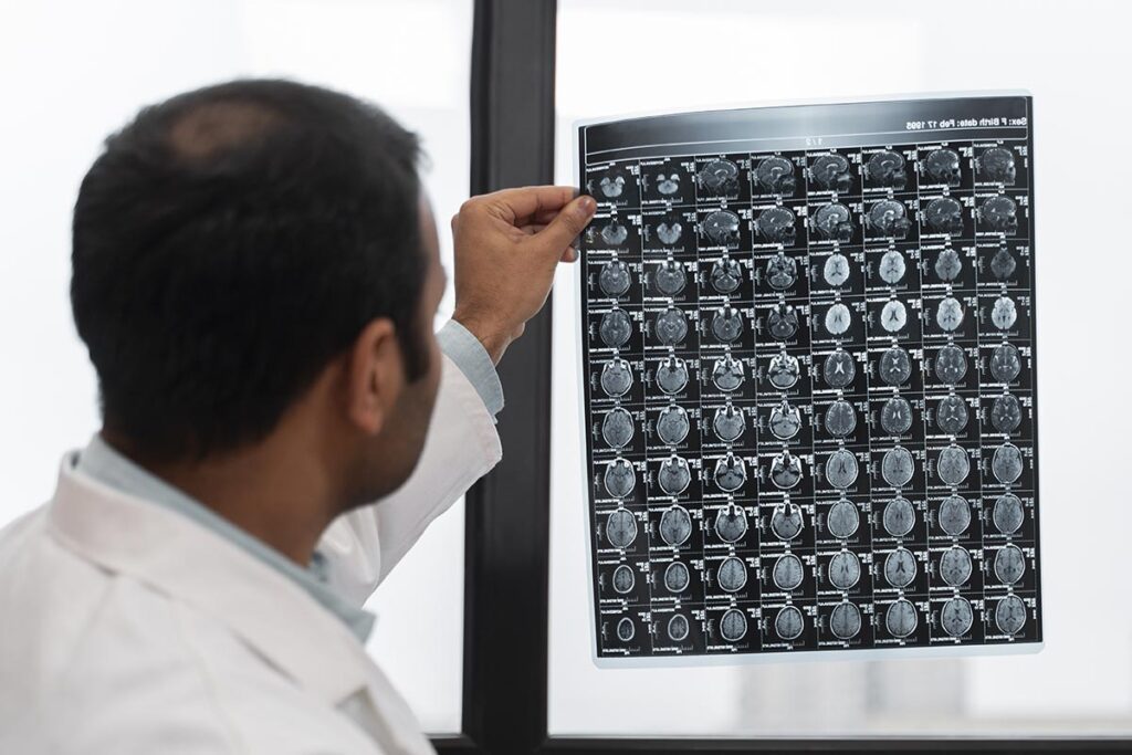 Un médecin, vu de dos, examine des radiographies du cerveau d'un patient. Il porte une blouse blanche, suggérant un environnement médical ou hospitalier. Cette image évoque l'importance de la santé neurologique et souligne les bienfaits de la marche à pied pour le bien-être mental et cérébral.